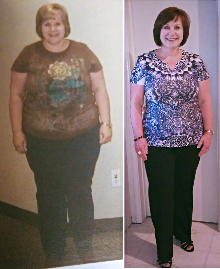 Lori transformation