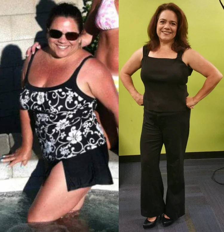 Susan transformation