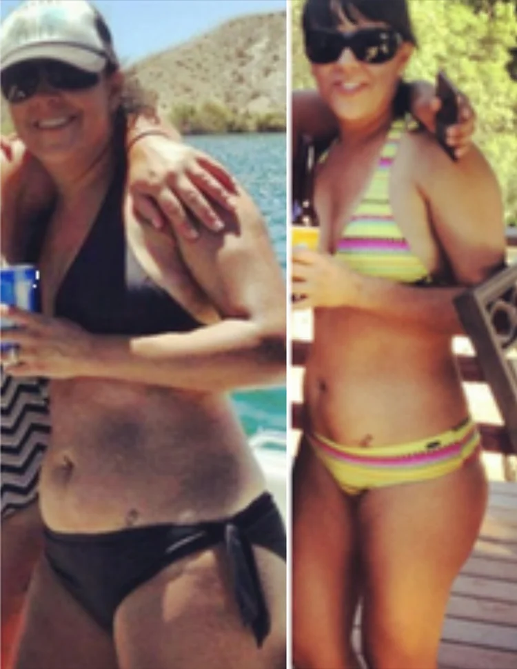 Raquel transformation